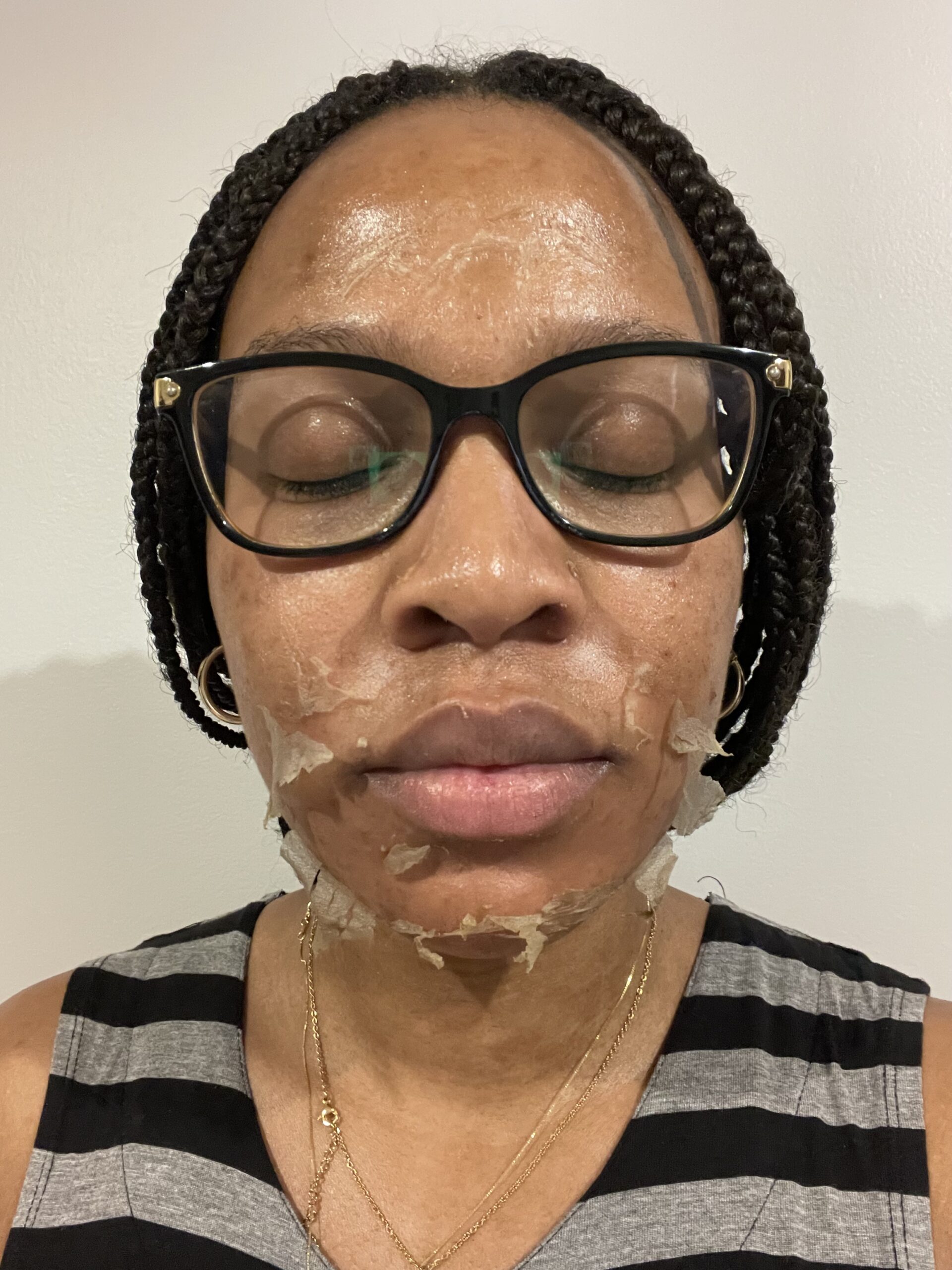 home made chemical facial peel Adult Pics Hq